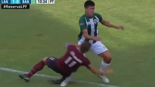 Terrible e insólito: Futbolista fracturó a rival por accidente y terminó expulsado