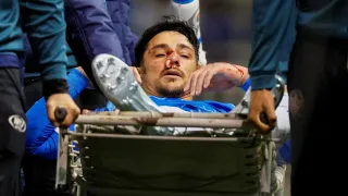Fractura nasal confirmada en Zampedri: lo que hizo igual este domingo