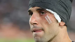 Buen estreno y final amargo: Lautaro Pastrán ilusionó en Colo Colo, pero terminó herido