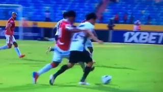 Imágenes sensibles: La dura fractura de brazo que sufrió futbolista brasileño