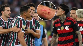 “Juego desleal”: Fluminense destroza a Erick Pulgar tras brutal patada que escandaliza a Brasil