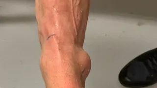 Neymar mostró el estado de su tobillo y envió un mensaje