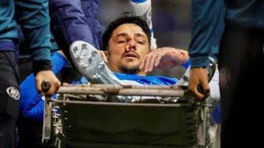 Fractura nasal confirmada en Zampedri: lo que hizo igual este domingo
