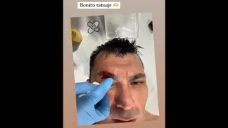 “Bonito tatuaje”: Gary Medel mostró las consecuencias de su choque con Zlatan