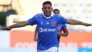 Las dificultades que tiene la U para el amistoso con Real Betis