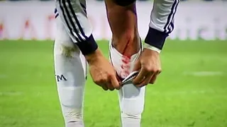 Cristiano Ronaldo sufrió un corte en una pierna, pero podrá jugar en la Champions
