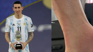 “Así siguió jugando”: Esposa mostró el tobillo de Angel Di María tras la final de Copa América