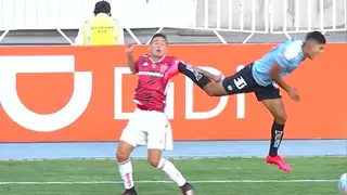 La fuerte patada que recibió en el rostro Matías Rodríguez en el duelo con O’Higgins