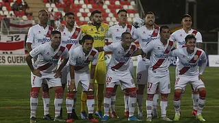 Curicó Unido confirmó que un futbolista dio positivo por coronavirus