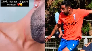 Mauricio Isla reclamó contra jugador de Magallanes que “tenía las uñas largas”