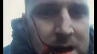 Hincha de Everton recibió cuchillazo en la cara durante pelea con hooligans de Millwall