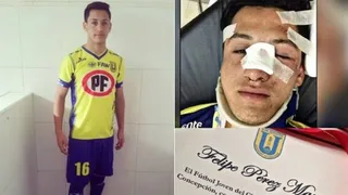 U. de Concepción premió a juvenil que se fracturó por trancar con la cabeza